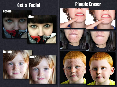 Pimple Remover HD
