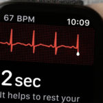 Keynote de presentación del iPhone XS, XS Max y XR Apple Watch Electrocardiograma