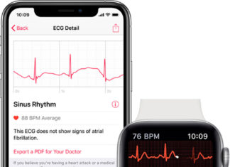 Electrocardiogramas en el Apple Watch